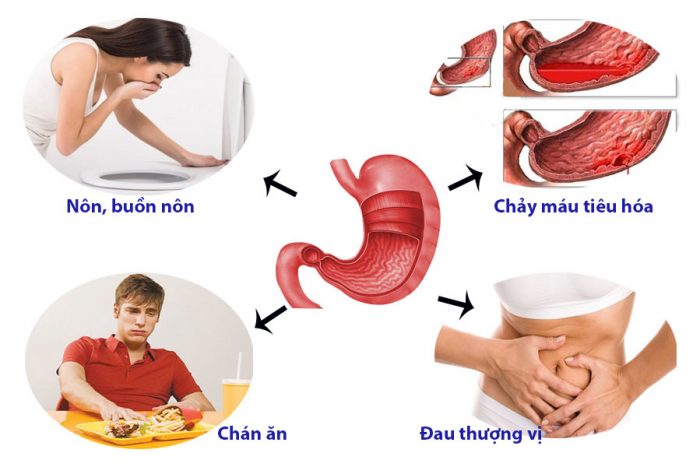 triệu chứng đau dạ dày, trung tâm chăm sóc sức khỏe Mandala Care