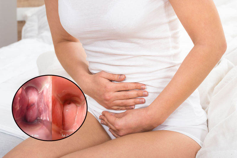 Điều trị viêm thận, viêm niệu đạo, viêm bàng quang cấp và mãn tính tại Trung Tâm Mandala Care